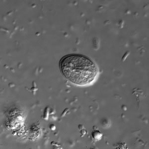 Giardia duodenalis cyst in a wet mount, differential interference contrast microscopy at 1000 times magnification.
